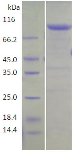 15% SDS-PAGE analysis profiles of purified AB57_1059-1-754 (CBB stained).